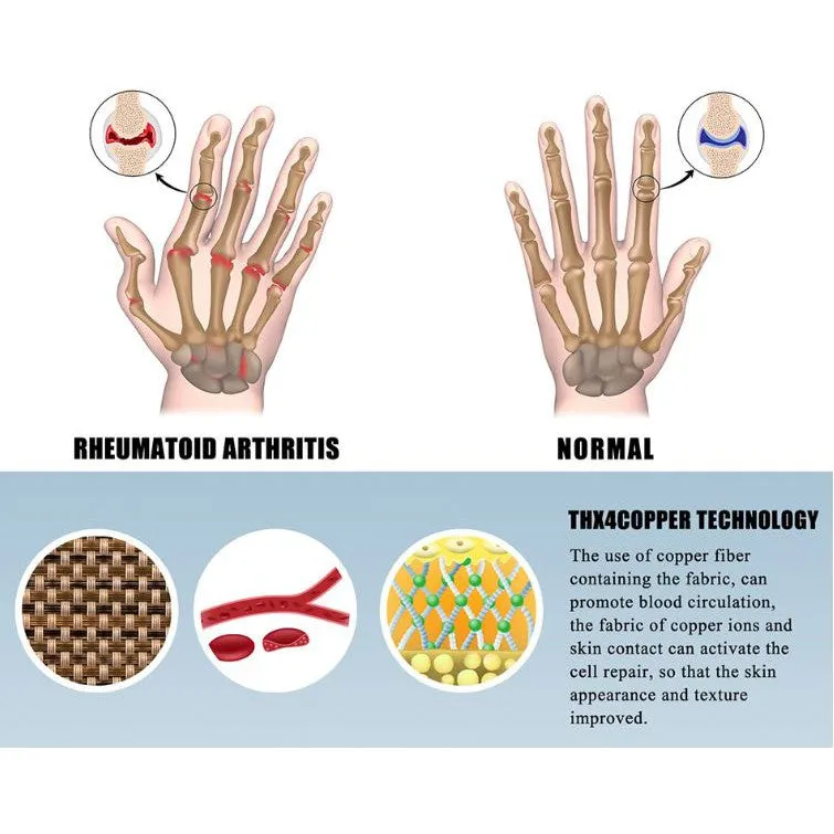 High-Quality Polyester and Cotton Arthritis Gloves, Sport Wrist Support, Joint Compression Gloves for Rheumatoid | Shopee Singapore