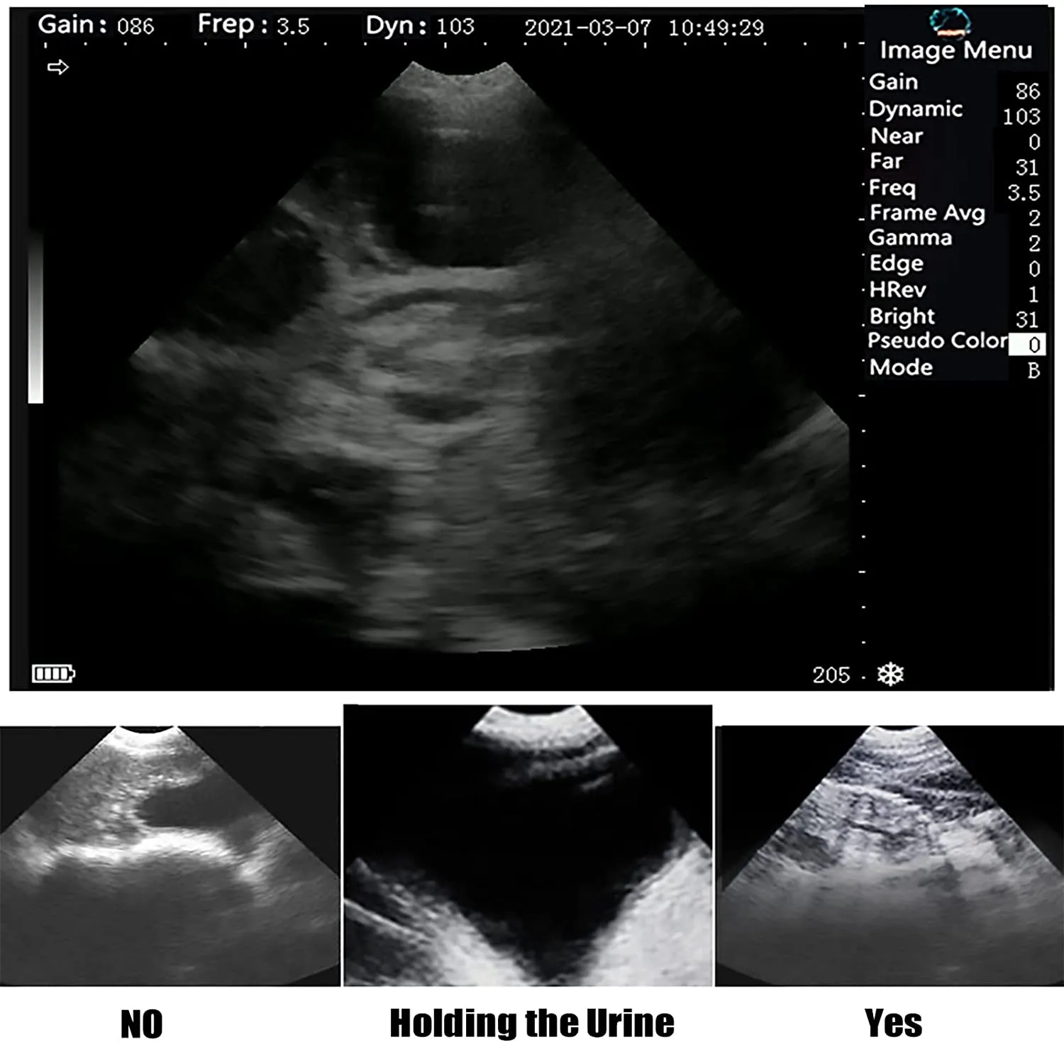 Ultrasound Scanner Veterinary for Pregnancy I Vet Digital Portable B-Ultra Sound Scanner Machine with 3.5 Mhz Convex Probe 8 Color Panels for Sheep, Dog, Cat and Pig Pregnancy Test